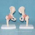 Human Natural Hip Joint Medical Care Model with Ligament (R020909)